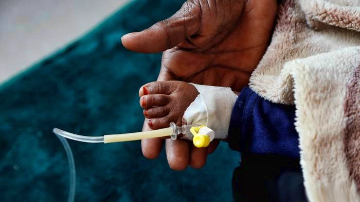 توفي عدد من الأطفال في مستشفيات يمنية يعتقد أن أدوية مزورة وعدم توفر الشروط المطلوبة كانت السبب في وفاتهم
